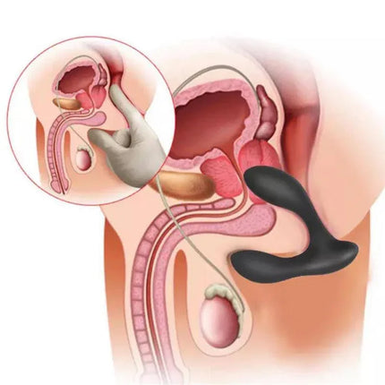 Illustration of Brett Prostate Massager Remote Control USB Liquid Silicone showing ergonomic design and anatomical placement.
