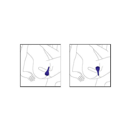 Illustration showing placement of Vibrating Ring Ping Fuchsia for enhanced stimulation and lasting pleasure.